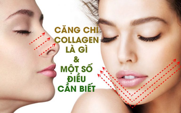 Căng chỉ collagen là gì? Một số điều nên biết về căng chỉ collagen